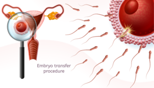 Embryo Transfer