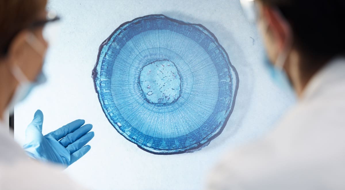 ICSI Cost in Ahmedabad — Transparent Pricing at Wellspring IVF